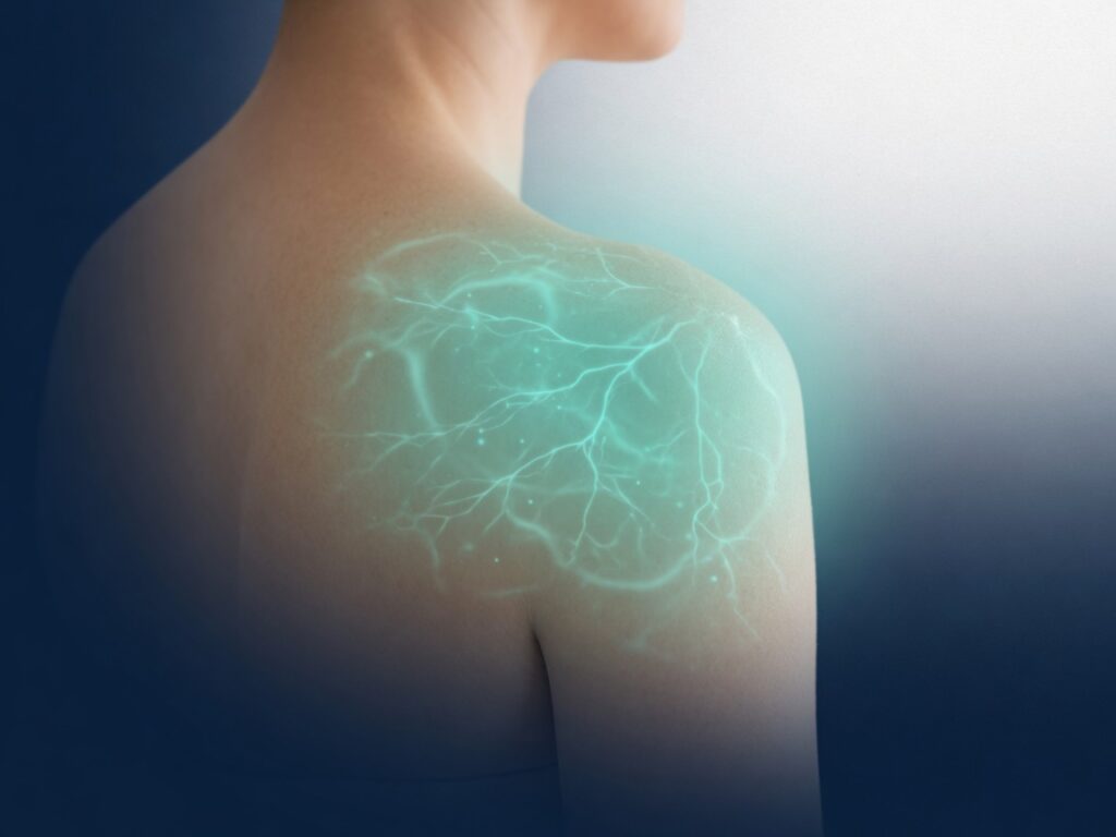 Terapia Regenerativa